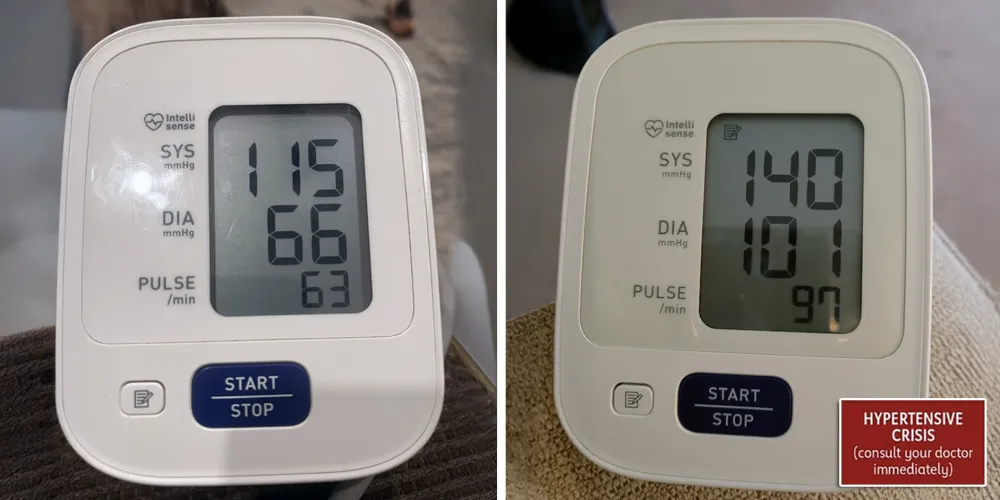 Blood pressure monitor showing dangerous reading vs normal reading after using The Sleepr Ergo