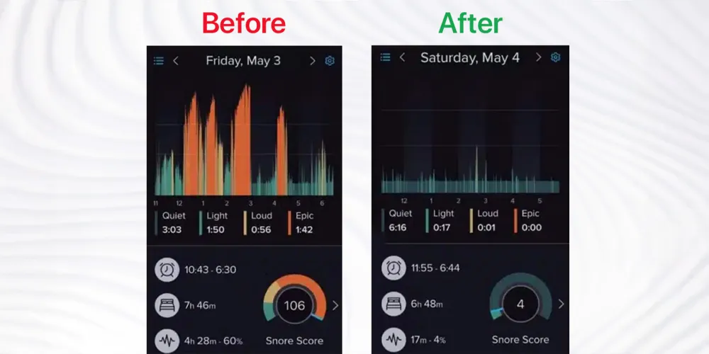 Sleep tracking comparison: before and after using The Sleepr Ergo