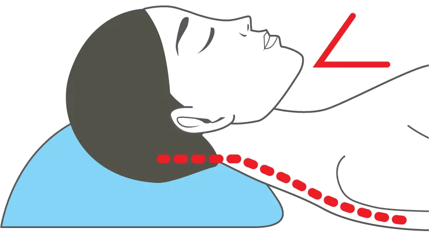 Diagram: chin down — less air and snoring