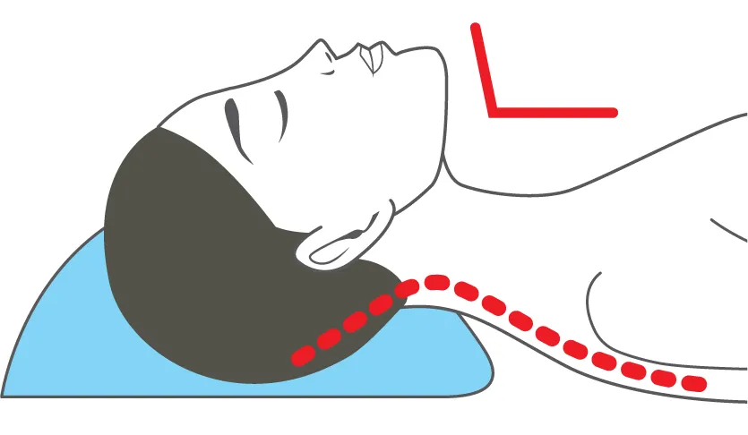 Diagram: chin tilted back — more air but a strained neck